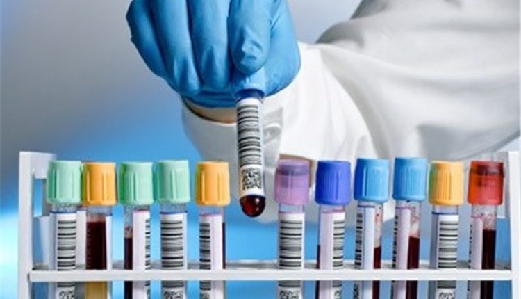 پلاسما درمانی کرونا